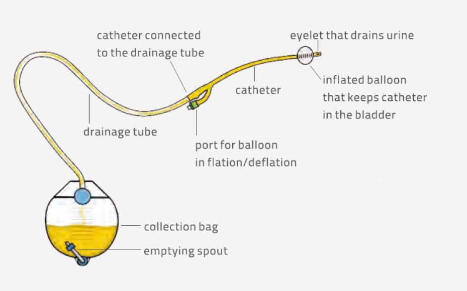 catheter parts diagram