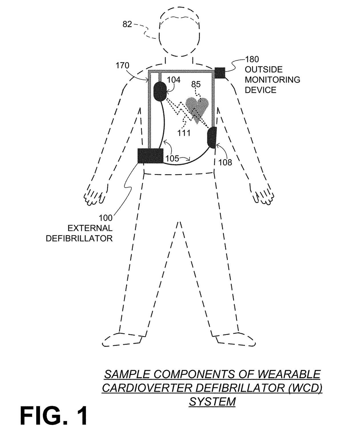 diagram defibrillator parts