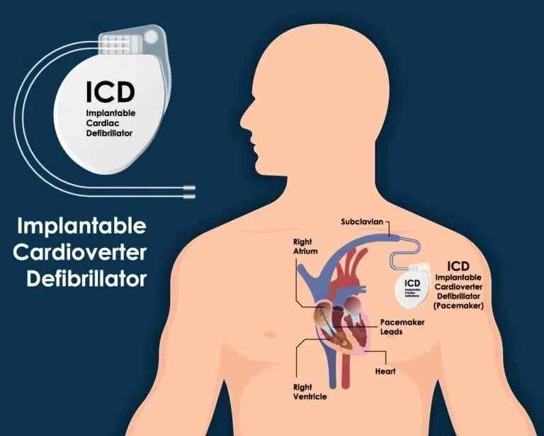 diagram defibrillator parts