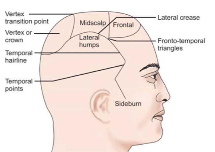 hair parting diagram